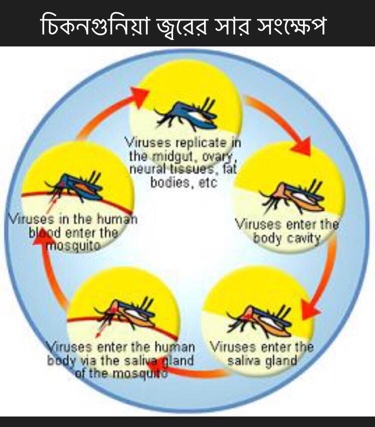 চিকনগুনিয়া জ্বরের সার সংক্ষেপ
