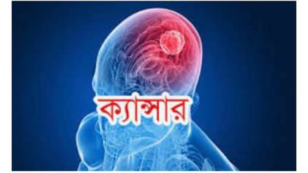 মাত্র দুটি কাজ করলেই প্রতিরোধ হবে ক্যান্সার